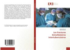 Buchcover von Les fractures bimalléolaires intertuberculaires