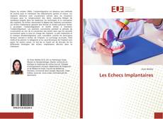 Les Echecs Implantaires的封面