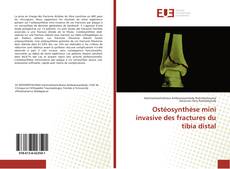 Copertina di Ostéosynthèse mini invasive des fractures du tibia distal
