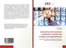 Copertina di Extraction des tumeurs cérébrales à partir des images scanographiques
