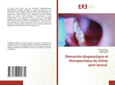 Copertina di Démarche diagnostique et thérapeutique du lichen plan buccal