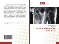 Buchcover von Le kyste hydatique des tissus mous