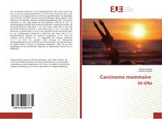 Обложка Carcinome mammaire in-situ