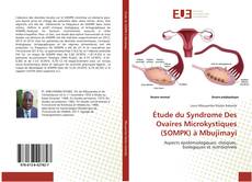 Copertina di Étude du Syndrome Des Ovaires Microkystiques (SOMPK) à Mbujimayi