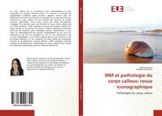 Copertina di IRM et pathologie du corps calleux: revue iconographique