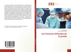 Capa do livro de Les fractures bifocales de la jambe 