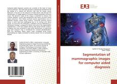 Обложка Segmentation of mammographic images for computer aided diagnosis