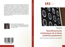 Buchcover von Ramollissements ischémiques de la fosse cérébrale postérieure