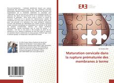 Обложка Maturation cervicale dans la rupture prématurée des membranes à terme