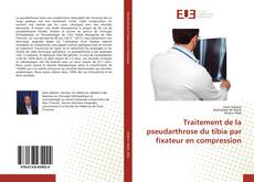 Buchcover von Traitement de la pseudarthrose du tibia par fixateur en compression