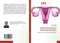 Hystérectomie pour Pathologie Bénigne的封面