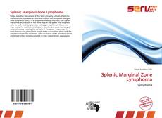 Bookcover of Splenic Marginal Zone Lymphoma