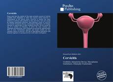 Bookcover of Cervicitis