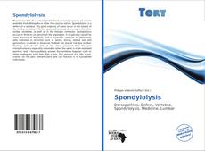 Borítókép a  Spondylolysis - hoz