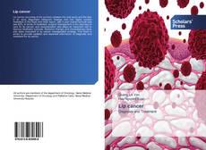 Buchcover von Lip cancer