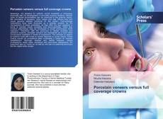 Buchcover von Porcelain veneers versus full coverage crowns