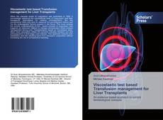 Buchcover von Viscoelastic test based Transfusion management for Liver Transplants