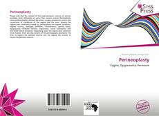 Bookcover of Perineoplasty