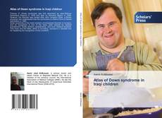 Atlas of Down syndrome in Iraqi children的封面