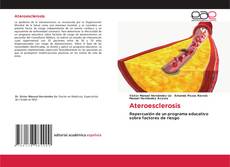 Bookcover of Ateroesclerosis