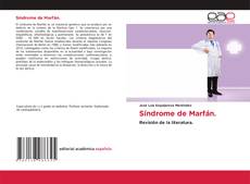 Bookcover of Síndrome de Marfán.