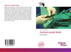 Portada del libro de Sentinel Lymph Node