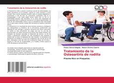 Buchcover von Tratamiento de la Osteoartiris de rodilla