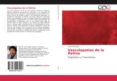Buchcover von Vasculopatías de la Retina