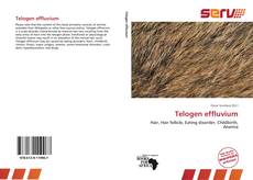 Buchcover von Telogen effluvium