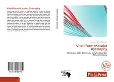 Capa do livro de Vitelliform Macular Dystrophy 