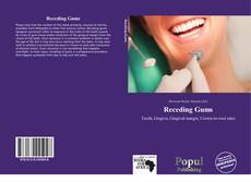 Copertina di Receding Gums