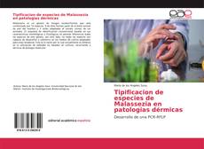 Bookcover of Tipificacion de especies de Malassezia en patologias dérmicas