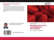 Bookcover of Modificación de la hemoglobina glicosilada