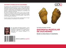 Couverture de DISTROFIA MUSCULAR DE DUCHENNE: