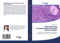 Portada del libro de Heterogenitatea histopatologică a tumorilor mamare maligne