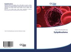 Buchcover von Syöpäkuolema