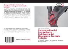 Bookcover of Comparación del Tratamiento Quirúrgico del Ligamento Cruzado Anterior