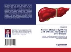 Copertina di Current Status of synthetic and antioxidant agents on Liver Disease