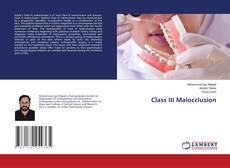 Bookcover of Class III Malocclusion