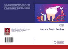 Buchcover von Post and Core in Dentistry