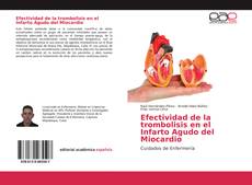 Portada del libro de Efectividad de la trombolisis en el Infarto Agudo del Miocardio