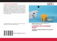 Portada del libro de Lesiones en la mucosa bucal