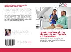 Lesión periapical con obturación retrógrada e injerto óseo kitap kapağı