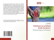 Couverture de Infections sur prothèse totale du genou