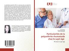 Bookcover of Particularités de la polyarthrite rhumatoide chez le sujet âgé