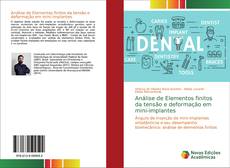 Bookcover of Análise de Elementos finitos da tensão e deformação em mini-implantes