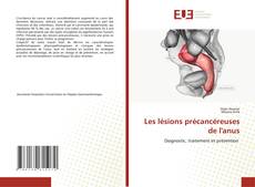 Capa do livro de Les lésions précancéreuses de l'anus 