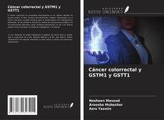Couverture de Cáncer colorrectal y GSTM1 y GSTT1