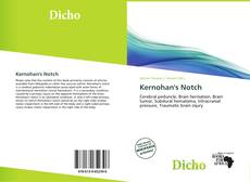Kernohan's Notch的封面