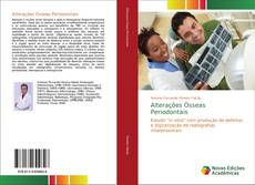 Copertina di Alterações Ósseas Periodontais